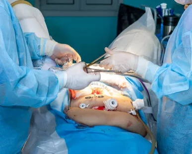 General & Laparoscopic Surgery